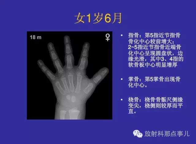 【PPT】正常女性骨龄图谱