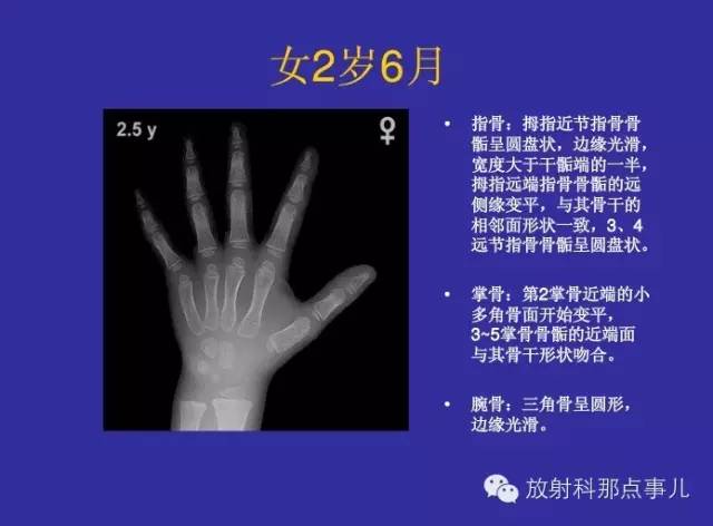 【PPT】正常女性骨龄图谱