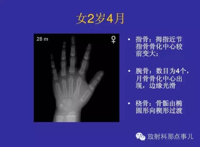 【PPT】正常女性骨龄图谱