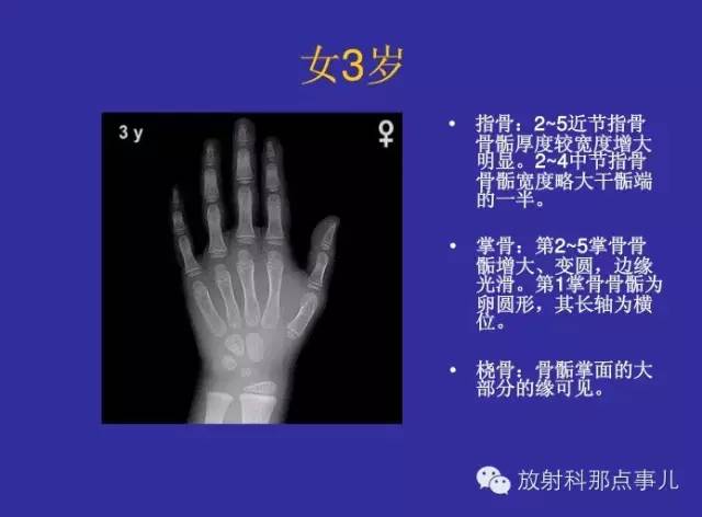 【PPT】正常女性骨龄图谱