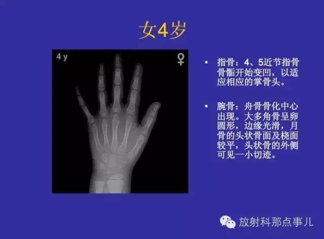 【PPT】正常女性骨龄图谱