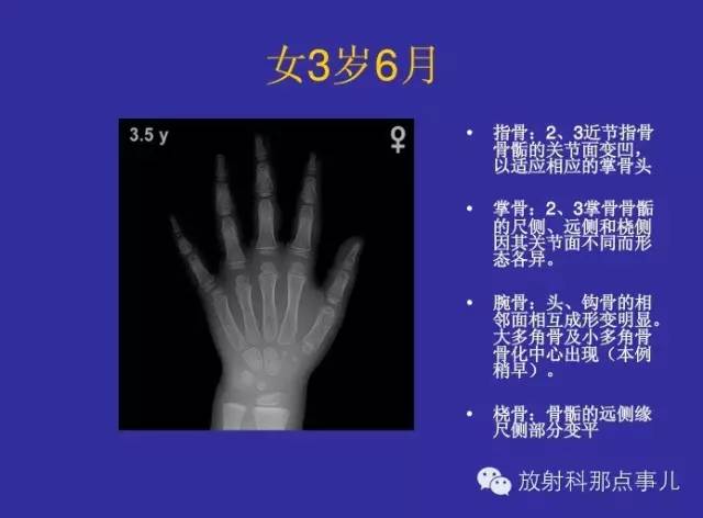 【PPT】正常女性骨龄图谱