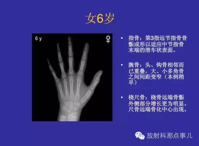 【PPT】正常女性骨龄图谱