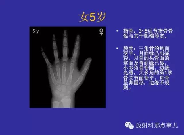 【PPT】正常女性骨龄图谱