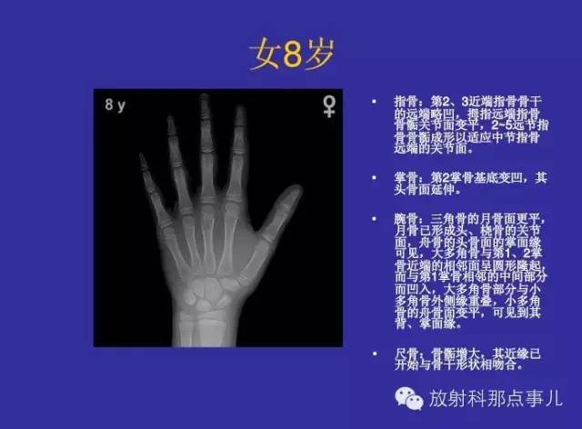 【PPT】正常女性骨龄图谱