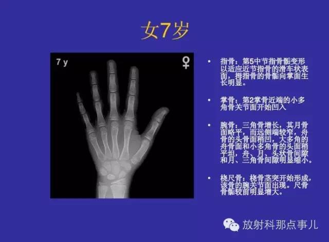 【PPT】正常女性骨龄图谱