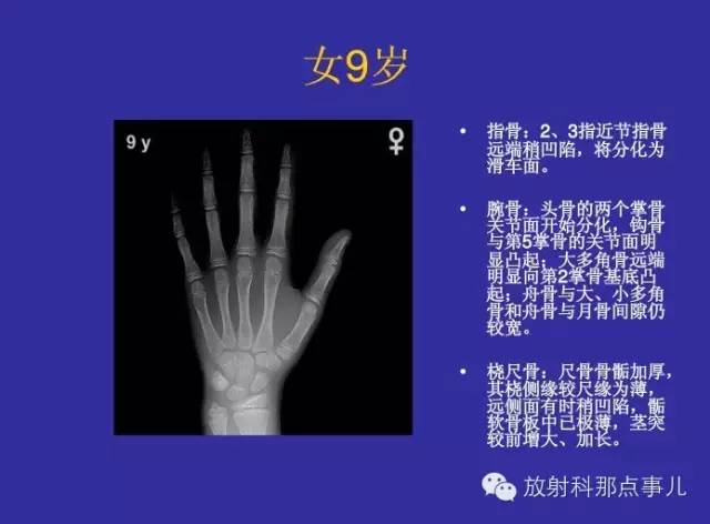 【PPT】正常女性骨龄图谱
