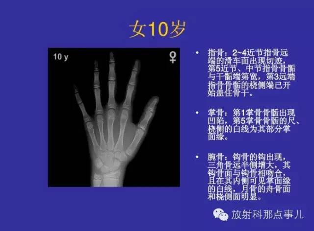 【PPT】正常女性骨龄图谱