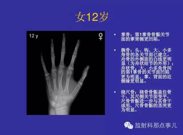 【PPT】正常女性骨龄图谱