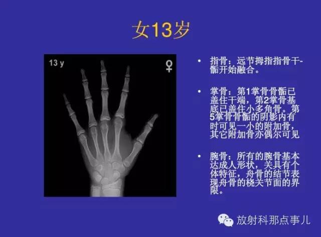 【PPT】正常女性骨龄图谱