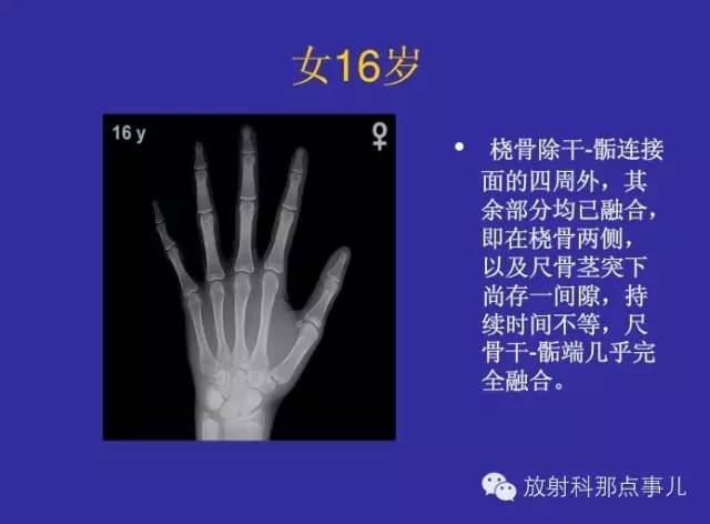 【PPT】正常女性骨龄图谱
