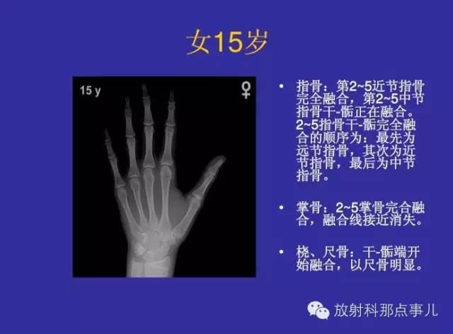 【PPT】正常女性骨龄图谱