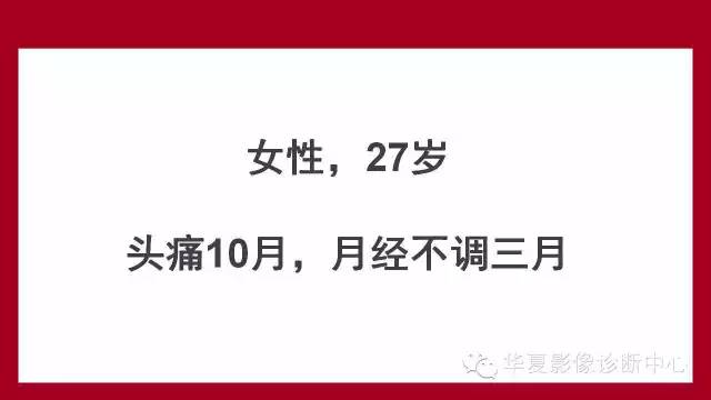 【病例】鞍区软骨粘液样纤维瘤1例CT及MR影像表现