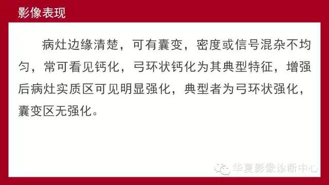【病例】鞍区软骨粘液样纤维瘤1例CT及MR影像表现