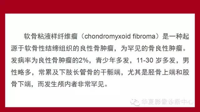 【病例】鞍区软骨粘液样纤维瘤1例CT及MR影像表现
