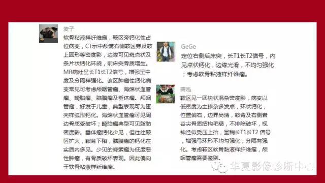 【病例】鞍区软骨粘液样纤维瘤1例CT及MR影像表现