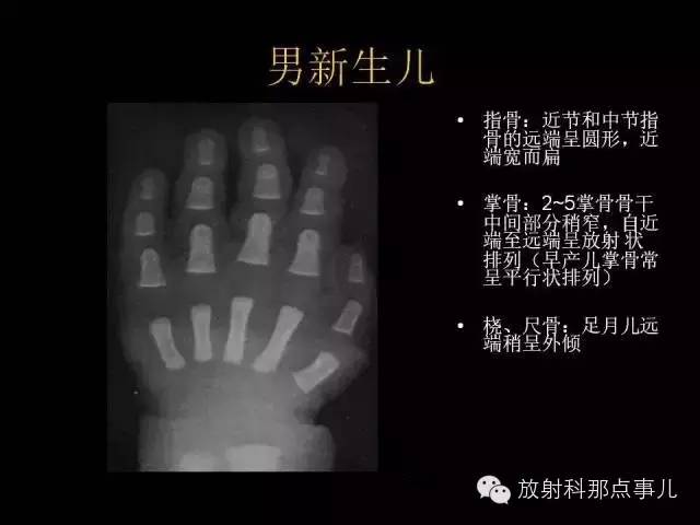 【PPT】正常男性骨龄图谱
