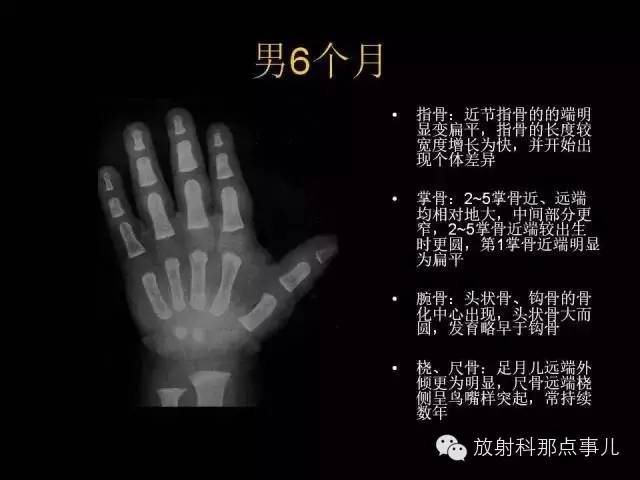 【PPT】正常男性骨龄图谱