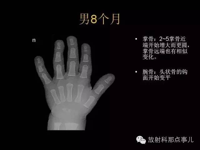 【PPT】正常男性骨龄图谱
