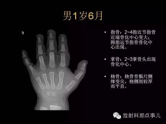 【PPT】正常男性骨龄图谱