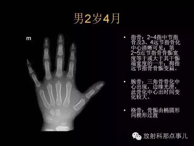 【PPT】正常男性骨龄图谱