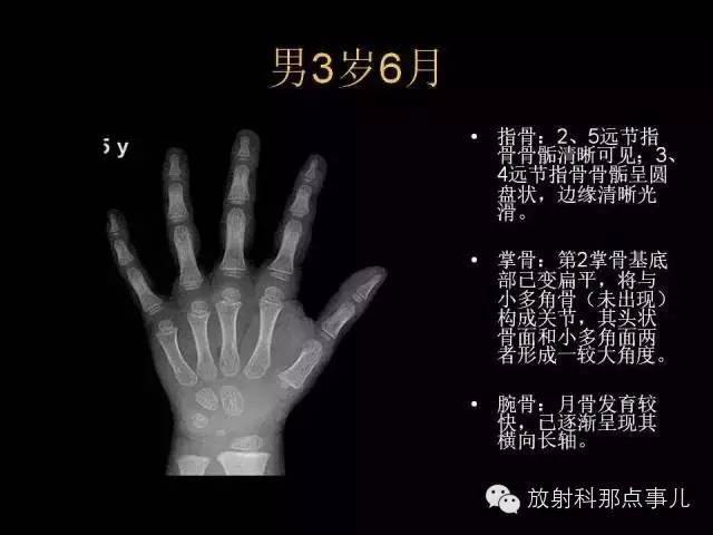 【PPT】正常男性骨龄图谱
