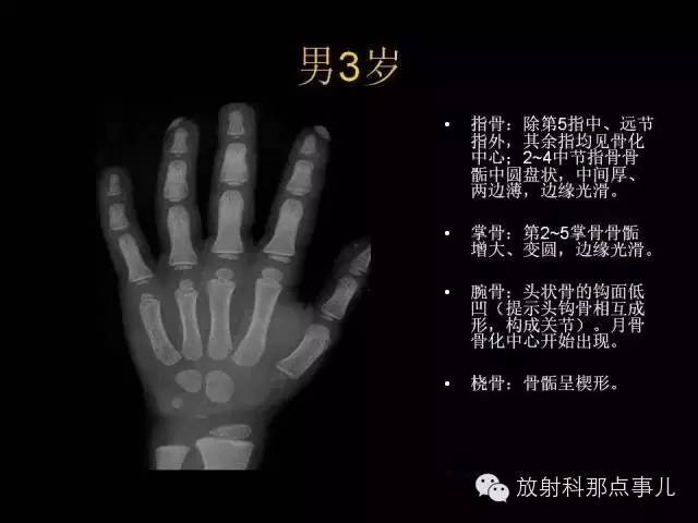 【PPT】正常男性骨龄图谱