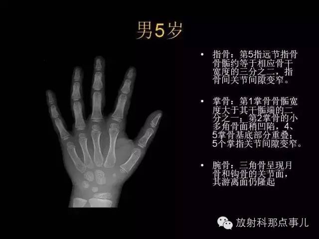【PPT】正常男性骨龄图谱