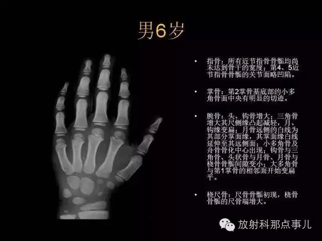 【PPT】正常男性骨龄图谱