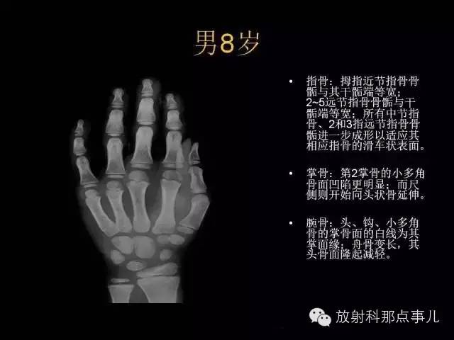 【PPT】正常男性骨龄图谱