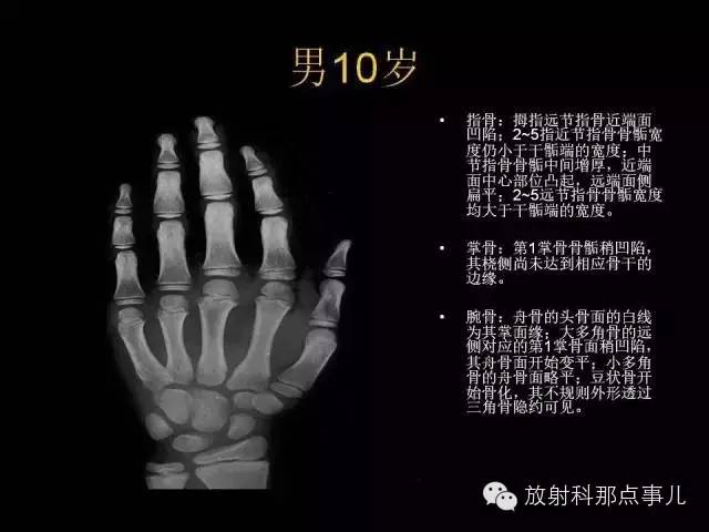 【PPT】正常男性骨龄图谱