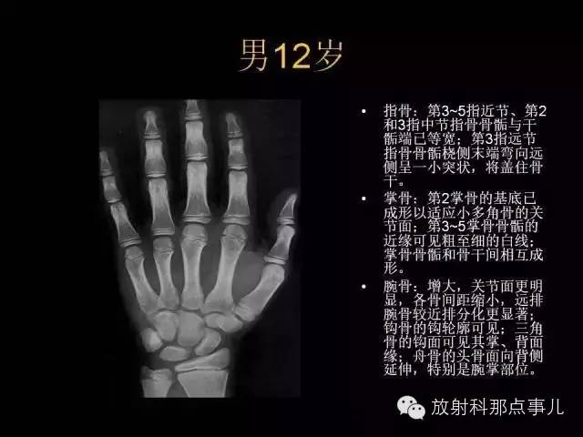 【PPT】正常男性骨龄图谱