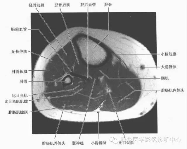 小腿部断层解剖+详细标注