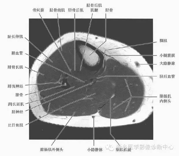 小腿部断层解剖+详细标注