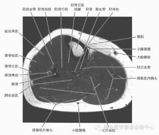 小腿部断层解剖+详细标注