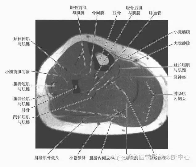 小腿部断层解剖+详细标注