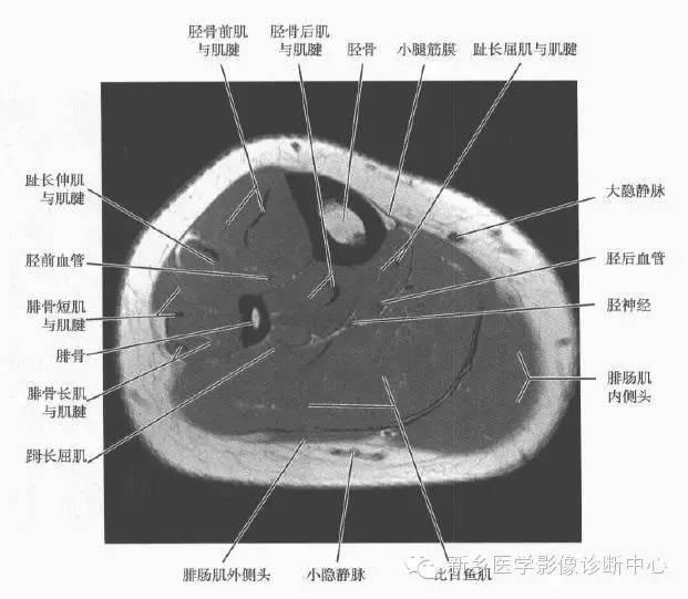 小腿部断层解剖+详细标注