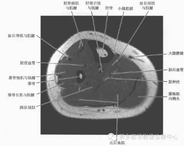 小腿部断层解剖+详细标注