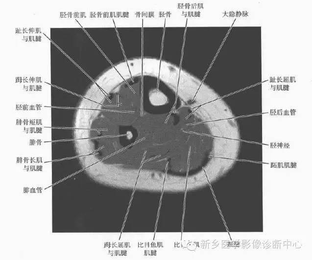小腿部断层解剖+详细标注