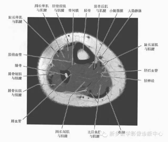 小腿部断层解剖+详细标注