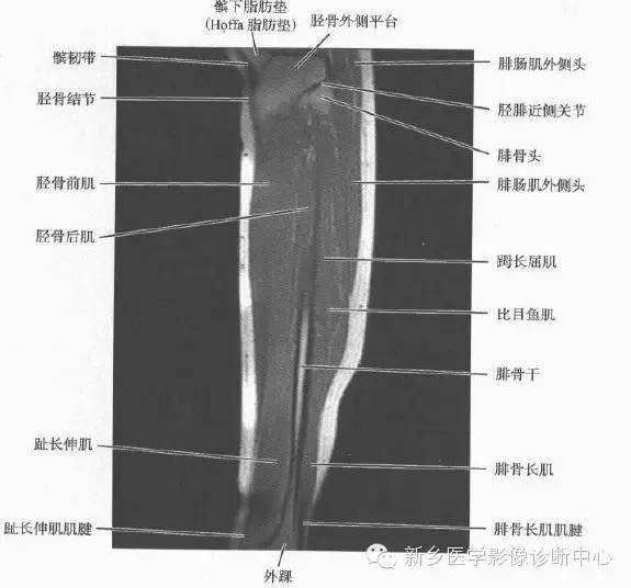 小腿部断层解剖+详细标注