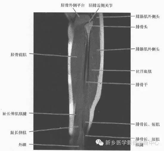 小腿部断层解剖+详细标注