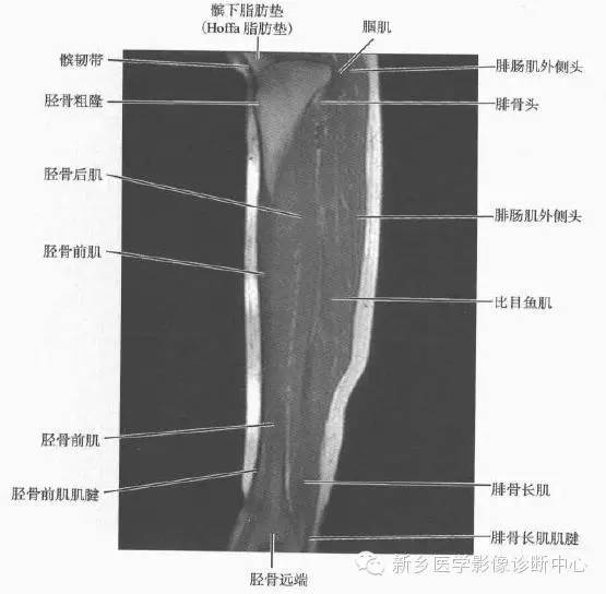 小腿部断层解剖+详细标注