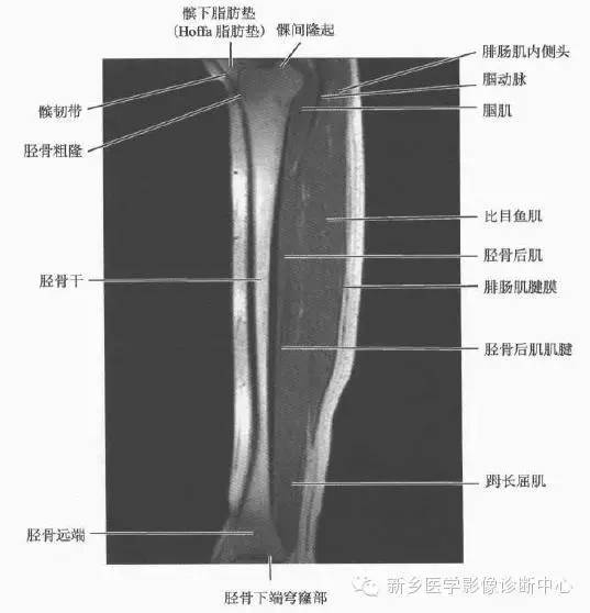 小腿部断层解剖+详细标注