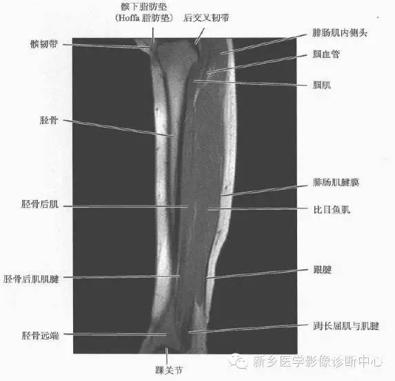 小腿部断层解剖+详细标注