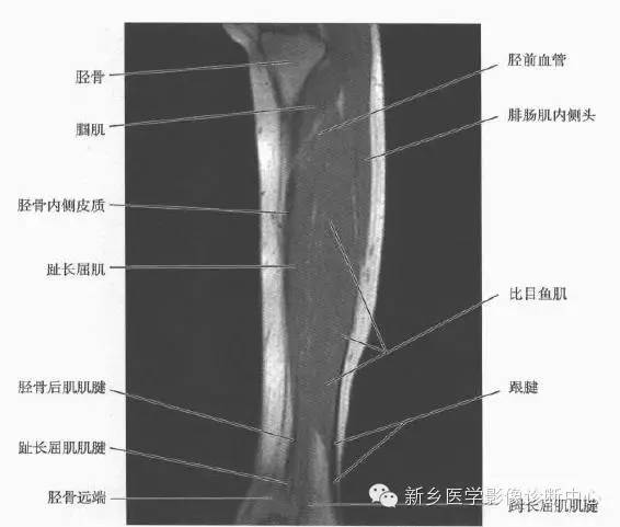 小腿部断层解剖+详细标注