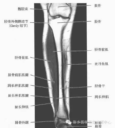 小腿部断层解剖+详细标注