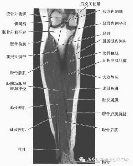 小腿部断层解剖+详细标注