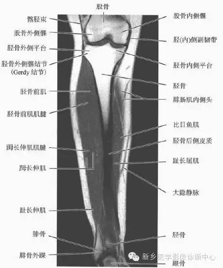 小腿部断层解剖+详细标注