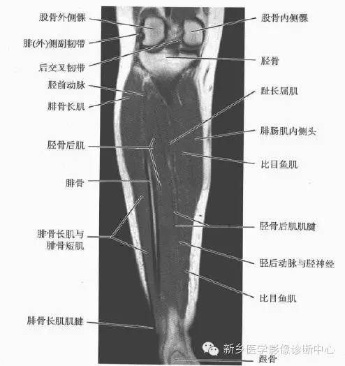 小腿部断层解剖+详细标注